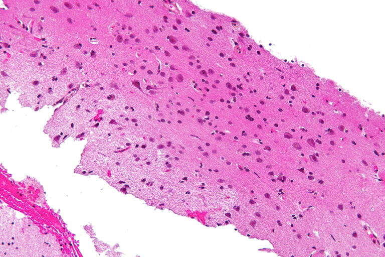 Grey Matter (Governance)